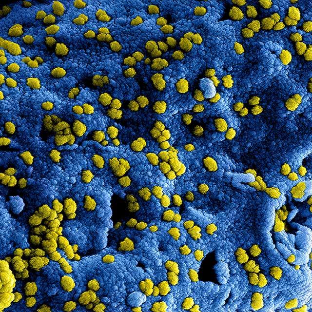 Computer Illustration of COVID-19
출처: ControlRisk
*https://www.controlrisks.com/our-thinking/insights/covid-19-the-geopolitical-implications-of-a-global-pandemic
